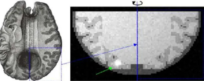 Fig. 9. The phantom (right) is derived from a sample slice of the brain [11] (left).  