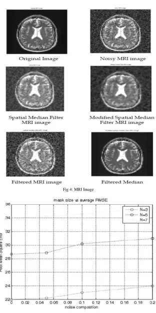 Fig 4: MRI Image 