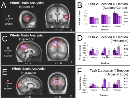 Figure 2.4 Neural regions demonstrating a significant location X emotion interaction in a whole brain analysis (Task 2)