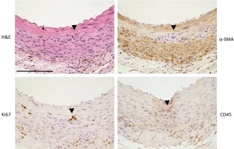 Figure 3.7 Ang II-infusion of SIRT6KO mouse shows greater degree of inflammatory  cell infiltration and aortic wall destruction compared to vehicle-control