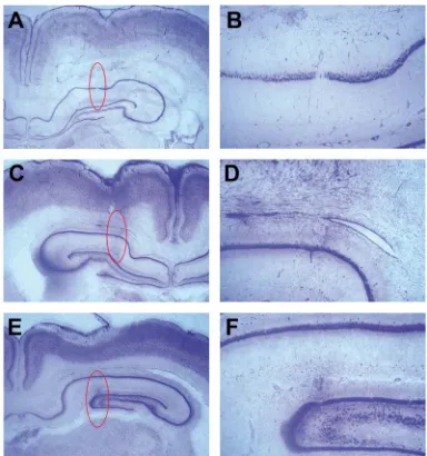 Figure 1. Localization of the electrode tracks. Photomicro- graphs of representative frontal slices (Nissl-stained, 20 mi- crometers in thickness) showing the microelectrode tracks (delineated by red in A, C, and E) in CA1 (A-D) and DG (E, F)