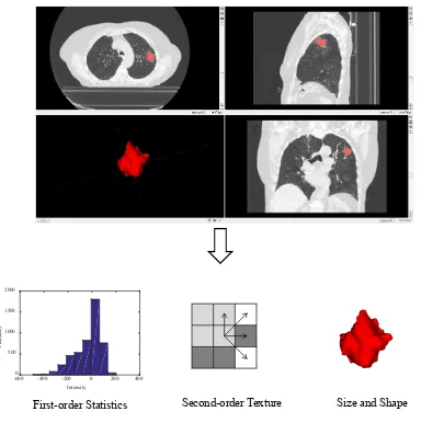 Figure 1-7: Radiomics involves image acquisition and region of interest delineation. An 
