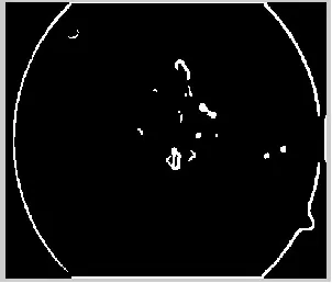 Figure 10: Circular binary mask for optic disc 