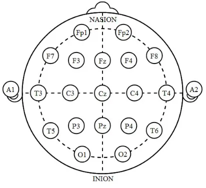 Figure 1. 10/20 System EEG. 