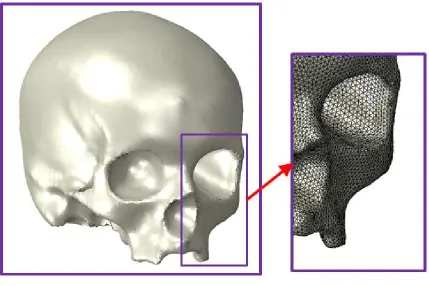 Figure 1-3 – Discretization of a skull from 3-D geometry into a finite element mesh. 