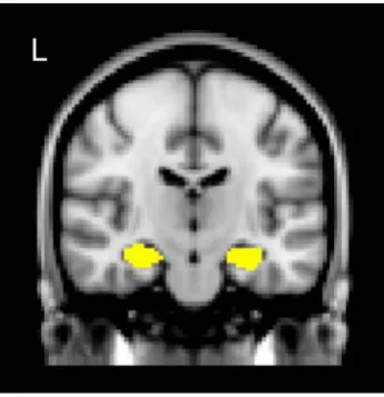 Figure 1. ROI masks (yellow) of left and right hippocampi (HPCs) determined on the ba-sis of Harvard-Oxford Subcortical Structural Atlas
