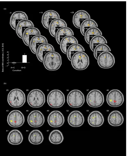 Figure 3. Imaging results. (a) Analysis of the statistical parametric mapping (SPM) results of the comparison of subjective i.e