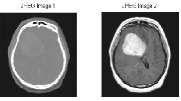 Figure 1a: input medical image for DCT fusion 