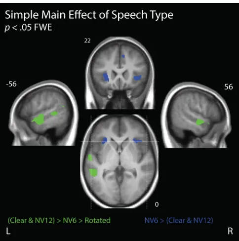 Figure 6. Simple main effect of Speech Type. Voxels that exhibited a significant simple main effect of Speech Type (Clear, NV12, NV6, or Rotated) during Attend-Speech are grouped by color: green indicates increasing BOLD activity with increasingly intellig