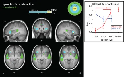 Figure 8. Speech × Task interaction. Left: Analyses were performed within a mask indicating cortex sensitive to speech