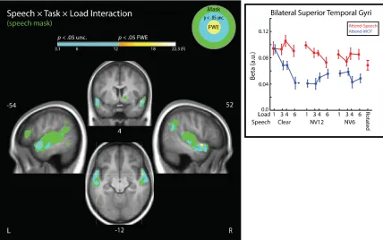 Figure 9. Speech × Task × Load Interaction. Left: Analyses were performed within the same mask used in Fig 7