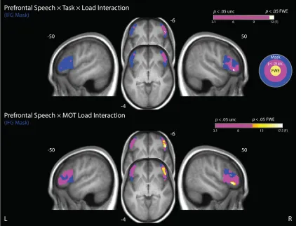 Figure 10. Prefrontal Interactions. Analyses were performed within a bilateral inferior frontal gyrus (IFG) region-of-interest defined using the LONI LPBA40 atlas (Shattuck et al., 2007), thresholded at a 50% maximum likelihood