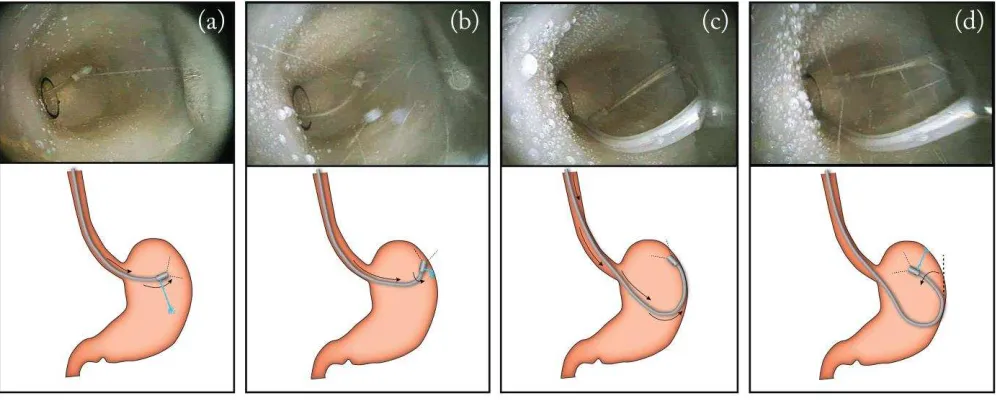 Fig. 9. Different phases of a retroflexion maneuver. 