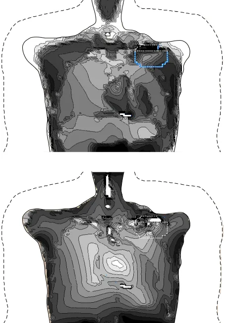 Figure 4. Current densities within a frontal plane across the CPM electrode tip induced by homogeneous magnetic fields 