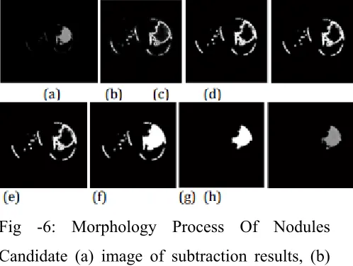 Fig -5: Subtraction process of image (a) Lung 