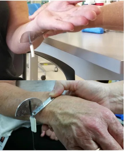 Figure 6. The MFG method for measuring forearm pronation and supination. 