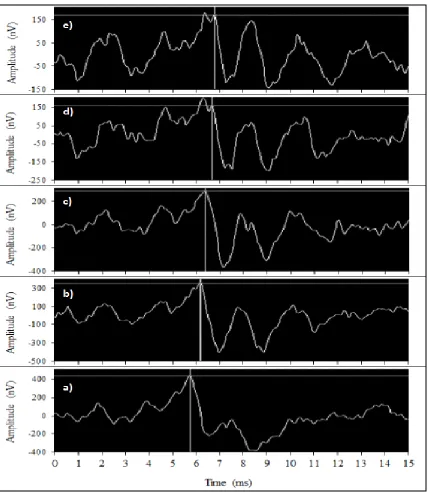 Figure 7:  Effect of increasing level of high-pass filtered pink noise on wave V 