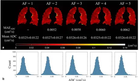 FIG. 1. CS simulation results for 3D (AF129Xe DW-MRI. Reconstructed magnitude image (b ¼ 0) for each AF, with corresponding MAE values ¼ 1; fully sampled dataset [SNR ¼ 25]).