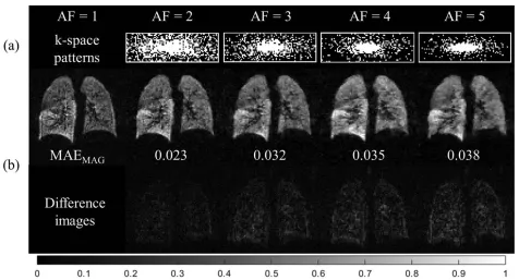 FIG. 1. Results from 3D 3He CS simulations. (a) Optimal variable-density k-space undersampling patterns (78 � 24 pixels) for each AFdetermined from CS simulations