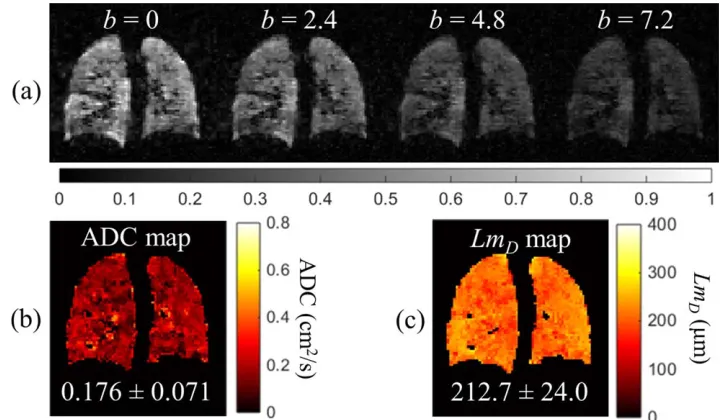 FIG. 2. ADC results from 3D 3He CS simulations. (a) ADC maps for an example slice at each AF, with corresponding MAEADC values