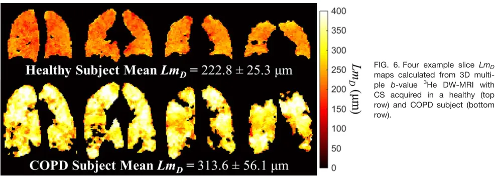 FIG. 6. Four example slice LmD