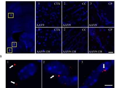 Figure 2. Viral particles are detected and distribute into distinct patterns in vivo (A) Confocal z-stack projections of images taken from coronal sections (40 µm) of adult mice (n = 3 mice were analyzed for both AAV9 and AAV9-138) show a clear fluorescent