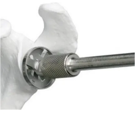 Figure 1-3 Glenoid reaming process  ‎