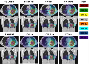 Figure 2-1. Dose distributions of the axial and coronal slice for each of the eight different 