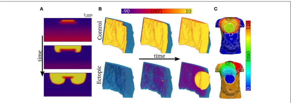 FIGURE 10 | Examples of abnormal electrical excitation.of the vulnerability windows. Three snapshots in time are shown to illustrate the potential of unidirectional conduction block to develop into asymmetric, re-entrant-likeactivity
