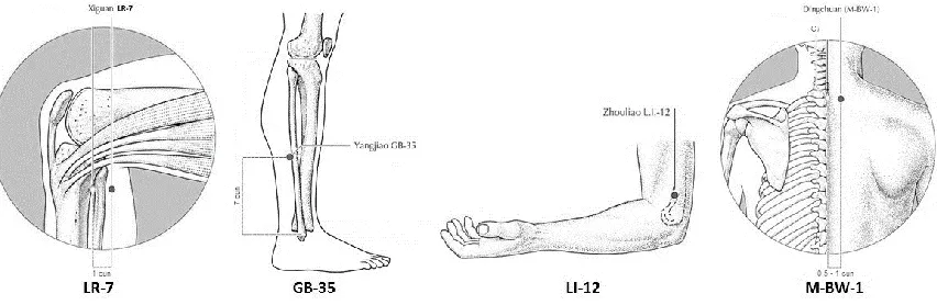 Figure 3: Acupoints for CA group (bilaterally) 