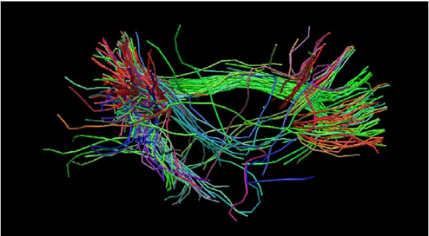 Figure 2.4 indicates the ﬁber tract orientation of the default mode network of the brain.