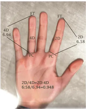 Figure 6: Digit Ratio Measurement 
