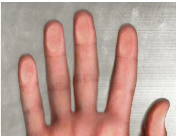 Figure 1: A difficult measurement: The lines are not clear. 