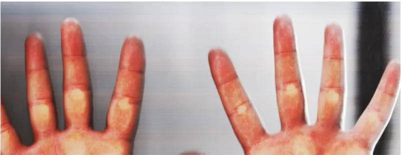 Figure 3: An incorrect scan:  Finger tips are not visible 