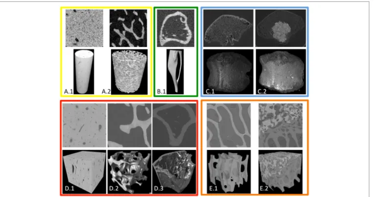 FigUre 1 | Overview of the different image types used for the deformable registrations with BoneDVC and/or DaVis-DC