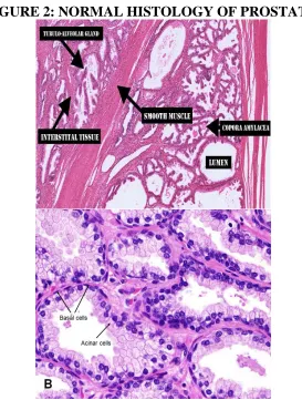 FIGURE 2: NORMAL HISTOLOGY OF PROSTATE. 