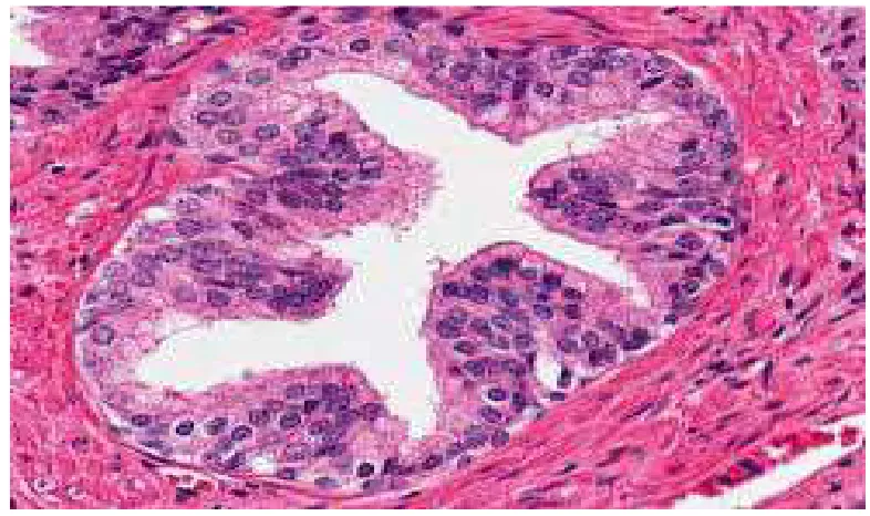 FIGURE 6: HISTOLOGY OF LOW GRADE PIN 