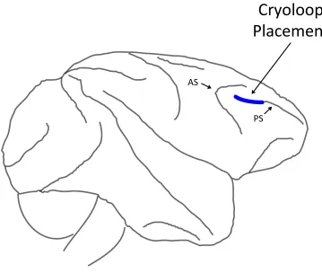 Figure 3. Cryoloop placement in the macaque prefrontal cortex. Cryoloops were 