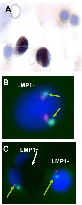 Figure 3. Immunohistochemistry using LMP1 antibodies and FISH analysis for chromosome 7 of the BM smears