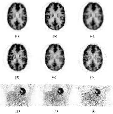Fig. 5. Transverse phantom view for images reconstructed with 21 subsets at the 105th sub-iteration: 360 s acquisition (5(a) OSEM 5mm Gaussian filter; 5(b) MRP, β=100; 5(c) QP, β=100); 36 s acquisition (5(d) OSEM 5mm Gaussian filter; 5(e) MRP, β=500; 5(f) 