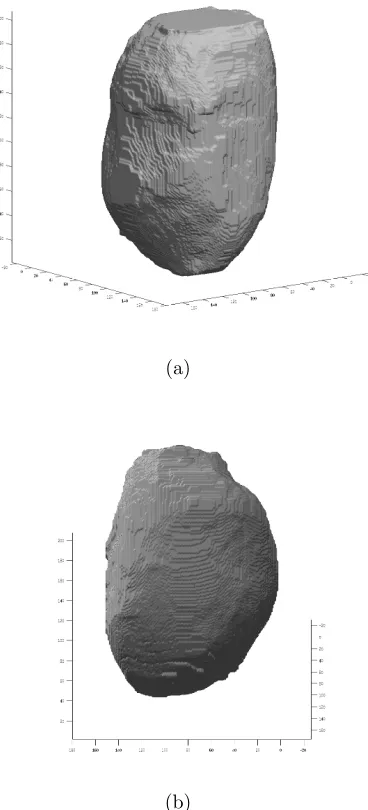 Figure 3.1: Two diﬀerent views of the same segmented primary GTV. Notethe top of the surface is ﬂat and this made the volume ﬁtting more challengingbecause the ﬂux width has to be wider to ensure that the entire surface iscontained
