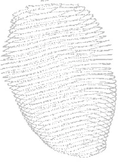Figure 3.3: Point cloud extracted from physician segmentations.