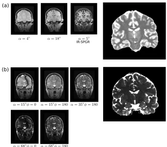 Figure 1.10: Quantitative Relaxometry. a) Estimation of a T1 map using DESPOT1-HIFI; b) Estima-tion of a T2 map using DESPOT2-FM.