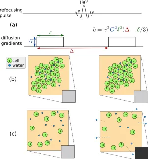 Figure 1.11: Measuring diﬀusion. a) diﬀusion gradients. The b-factor characterizes a diﬀusion se-quence and relates to the shape and spacing of the diﬀusion gradients; b) low diﬀusion: Brownianmotion of water molecules is restricted and the net eﬀect of the diﬀusion weighing is minimal; c) highdiﬀusion: there is a drop in signal due to the free motion of water molecules outside of the voxel, whichchanges the net eﬀect of the diﬀusion gradients.