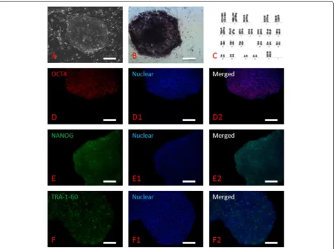 Figure 3 Differentiation abilities of human parthenogenetic embryonic stem cells. In vitro differentiated EBs displayed (A) positive AFP staining(endoderm), (B) positive SMA staining (mesoderm), (C) positive TUBULIN staining (ectoderm), and (D) expression 