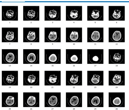 FIGURE 3: fMRI sequences 