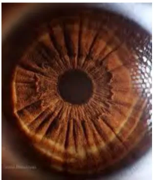 Figure 2.1: Example of iris pattern 