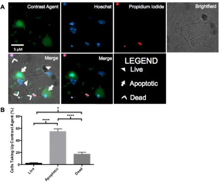 Figure 9. Apoptotic neurons selectively retain the contrast agent. Mouse primary cortical neurons were treated with CPT and exposed to 10 µM contrast agent for 4 hours