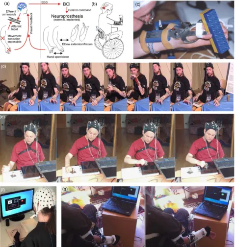 Figure 1. (a) General idea of bypassing the interrupted pathways in the spinal cord with the help of a BCI and motor neuroprosthetics to restore hand and arm function by decoding of motor intentions