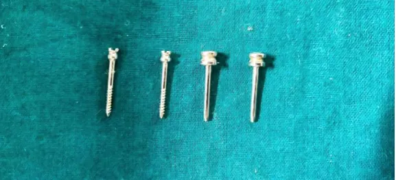 Fig 10 ANCHORING PINS. 